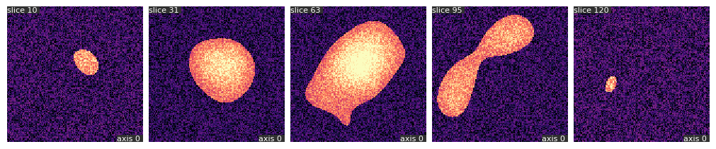 median-filter-before