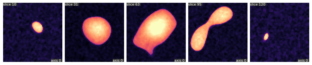 median-filter-after