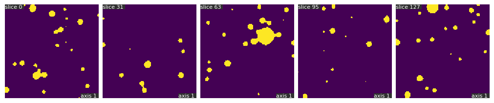 operations-watershed_before