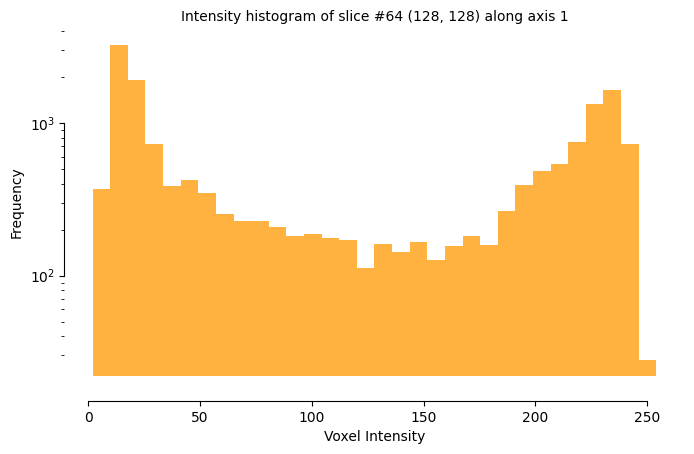 viz histogram